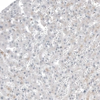Immunohistochemical staining of human liver shows no positivity in hepatocytes as expected.