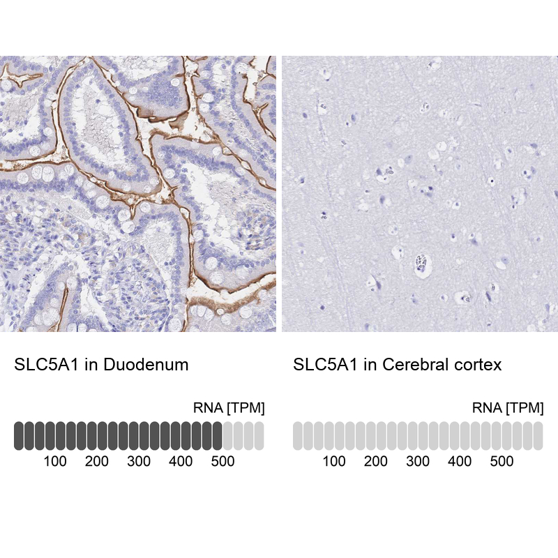 Anti-SLC5A1 Antibody