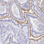 Immunohistochemical staining of human duodenum shows strong membranous positivity in glandular cells.