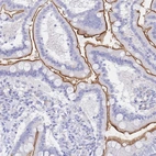 Immunohistochemical staining of human duodenum shows strong membranous positivity in glandular cells.