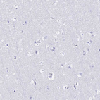 Anti-SLC5A1 Antibody