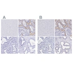 Immunohistochemical staining of human cerebral cortex, duodenum, endometrium and prostate using Anti-SLC5A1 antibody HPA055106 (A) shows similar protein distribution across tissues to independent antibody HPA051805 (B).