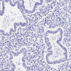 Immunohistochemical staining of human endometrium shows no positivity in glandular cells as expected.
