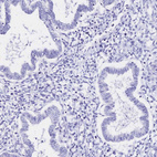Anti-SLC5A1 Antibody