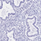 Immunohistochemical staining of human endometrium shows no positivity in glandular cells as expected.