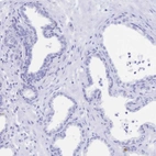 Immunohistochemical staining of human prostate shows no positivity in glandular cells as expected.