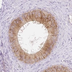 Anti-LHFPL5 Antibody