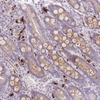 Immunohistochemical staining of human duodenum shows strong cytoplasmic positivity in lymphocytes.