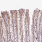 Immunohistochemical staining of human stomach shows moderate cytoplasmic positivity in glandular cells.