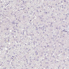 Anti-LHFPL5 Antibody