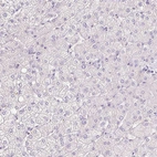 Immunohistochemical staining of human liver shows no cytoplasmic positivity in hepatocytes as expected.