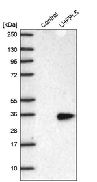 Western blot analysis in control (vector only transfected HEK293T lysate) and LHFPL5 over-expression lysate (Co-expressed with a C-terminal myc-DDK tag (~3.1 kDa) in mammalian HEK293T cells, LY405500).