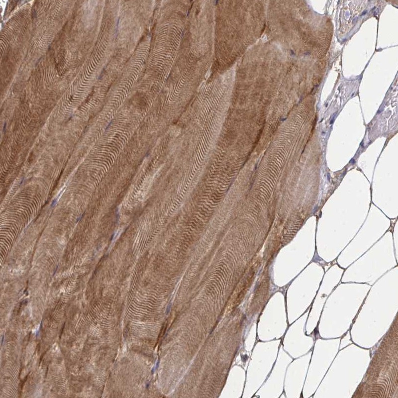 Anti-ZSCAN25 Antibody