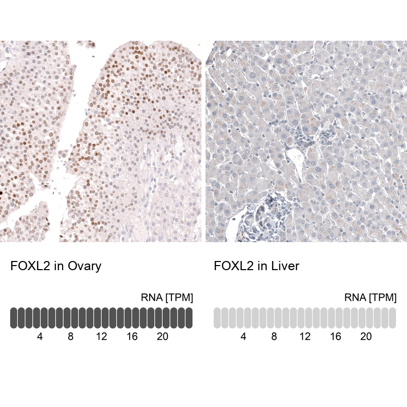 Anti-FOXL2 Antibody