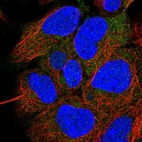 Immunofluorescent staining of human cell line HEK 293 shows localization to cytosol.