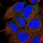 Immunofluorescent staining of human cell line HEK 293 shows localization to cytosol.