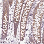 Immunohistochemical staining of human colon shows weak to moderate granular cytoplasmic positivity in glandular cells.