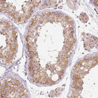 Immunohistochemical staining of human testis shows moderate granular cytoplasmic positivity in cells in seminiferous ducts.