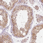 Immunohistochemical staining of human testis shows moderate granular cytoplasmic positivity in cells in seminiferous ducts.