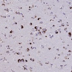 Anti-GPR162 Antibody