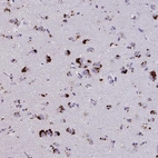 Immunohistochemical staining of human cerebral cortex shows high expression.