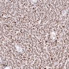 Anti-FOXL2 Antibody