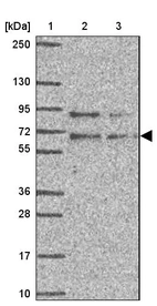 Lane 1: Marker [kDa] 250, 130, 95, 72, 55, 36, 28, 17, 10_br/_Lane 2: Human cell line RT-4_br/_Lane 3: Human cell line U-251MG sp