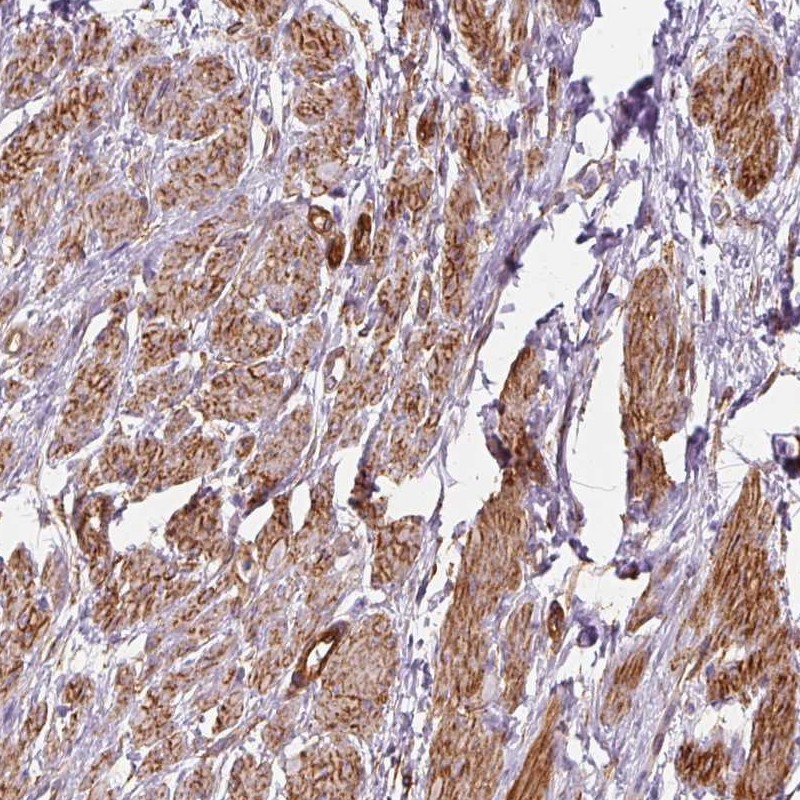 Anti-PRKCDBP Antibody