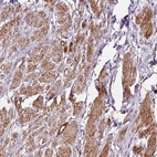 Anti-PRKCDBP Antibody