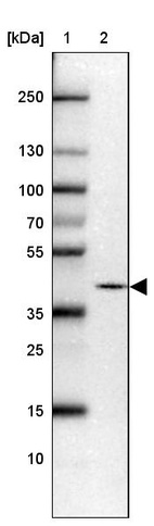Anti-PRKCDBP Antibody