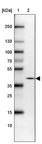 Lane 1: Marker [kDa] 250, 130, 100, 70, 55, 35, 25, 15, 10_br/_Lane 2: Human cell line U-87 MG