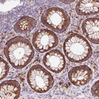 Immunohistochemical staining of human rectum shows strong cytoplasmic positivity in glandular cells and a subset of leukocytes.