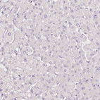 Immunohistochemical staining of human liver shows no positivity in hepatocytes as expected.