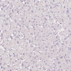 Immunohistochemical staining of human liver shows no positivity in hepatocytes as expected.