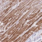 Immunohistochemical staining of human heart muscle shows strong cytoplasmic positivity in cardiomyocytes.