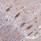 Immunohistochemical staining of human cerebellum shows moderate granular cytoplasmic positivity in Purkinje cells.