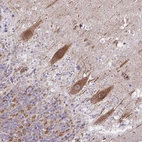 Immunohistochemical staining of human cerebellum shows moderate granular cytoplasmic positivity in Purkinje cells.