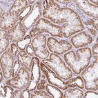 Immunohistochemical staining of human kidney shows moderate granular cytoplasmic positivity in cells in tubules.