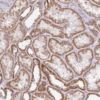 Immunohistochemical staining of human kidney shows moderate granular cytoplasmic positivity in cells in tubules.