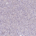 Immunohistochemical staining of human pancreas shows very weak granular cytoplasmic positivity in exocrine glandular cells.