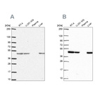 Western blot analysis using Anti-NDUFS2 antibody HPA055140 (A) shows similar pattern to independent antibody HPA061953 (B).