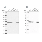 Western blot analysis using Anti-NDUFS2 antibody HPA055140 (A) shows similar pattern to independent antibody HPA061953 (B).