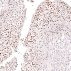 Immunohistochemical staining of human ovary shows moderate nuclear positivity in follicle (granulosa) cells.