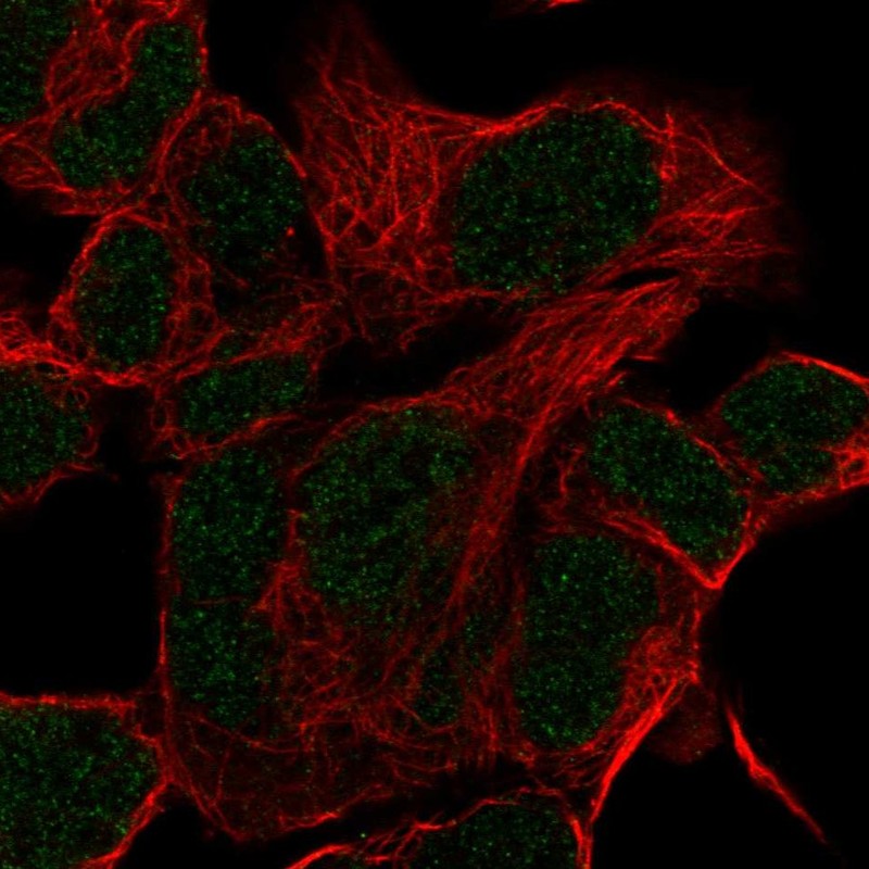 Anti-HOXD11 Antibody
