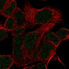 Anti-HOXD11 Antibody