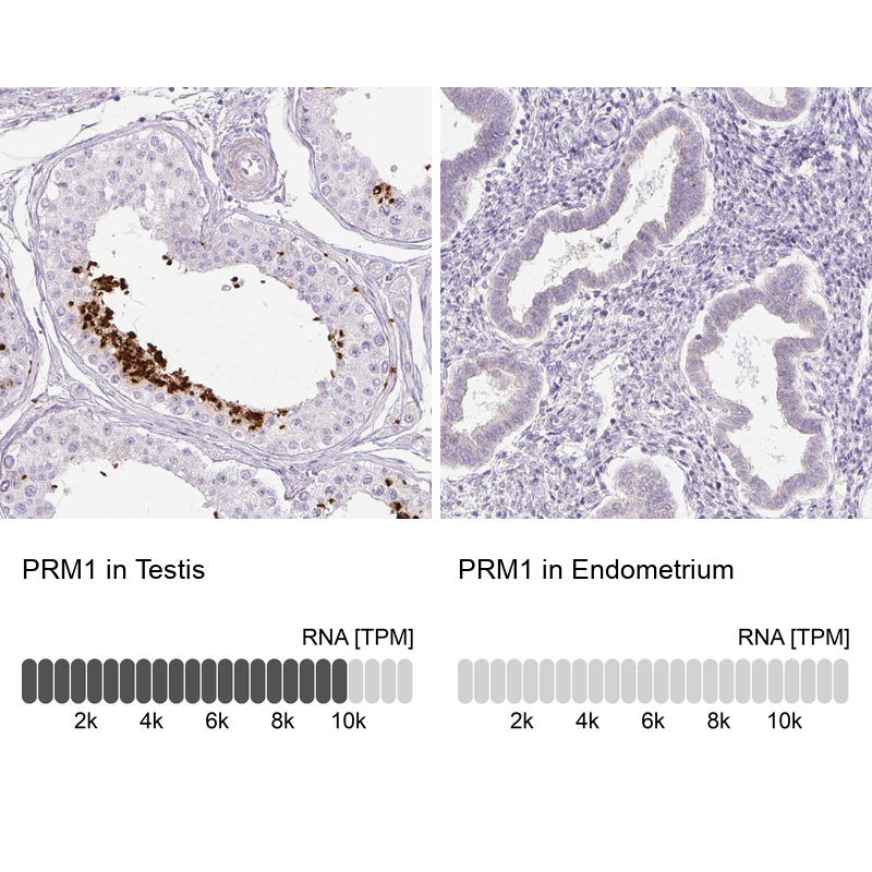 Anti-PRM1 Antibody