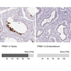 Anti-PRM1 Antibody