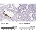 Anti-PRM1 Antibody
