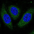 Anti-ASPH Antibody