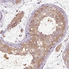 Anti-CFAP65 Antibody